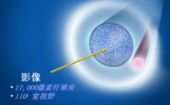 美国Endo Optiks E2眼内窥镜