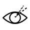 高度近视